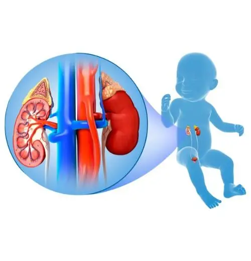 Prof. Dr. Abid Hossain providing pediatric urology care.